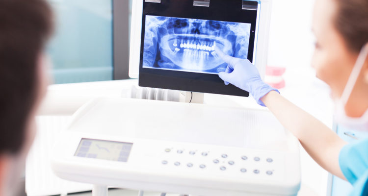 radiologia dentale